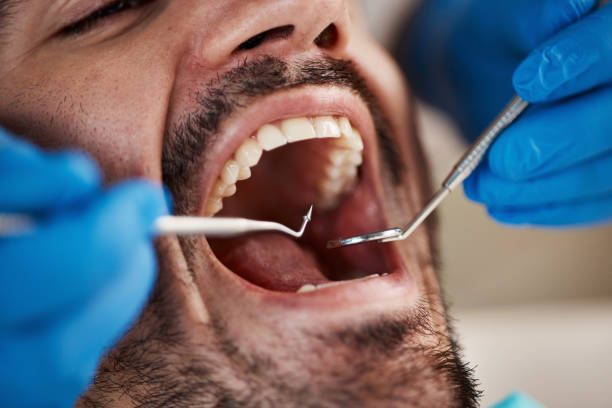 Best Emergency Dental Care for Abscessed Tooth in Williamsport, IN