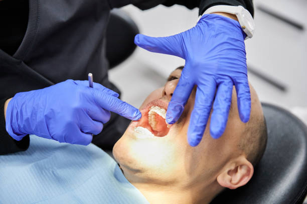 Best Broken or Cracked Tooth Emergency Dentist in Williamsport, IN