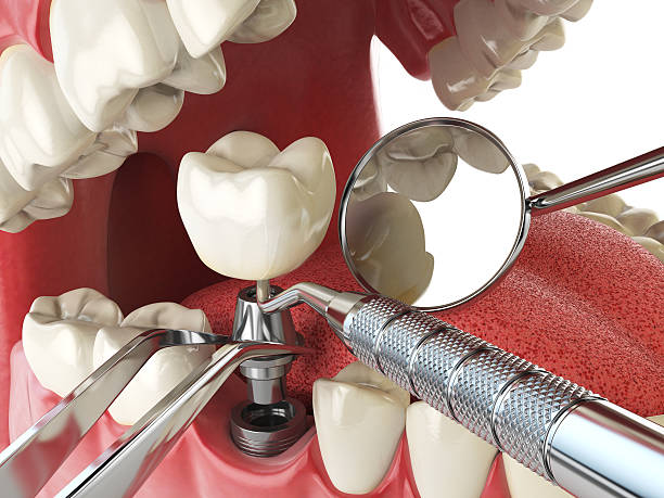 Best Holiday Emergency Dentist in Williamsport, IN
